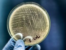 A Petri dish ccontaining coloniues of E. coli held in a goved hand